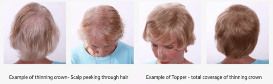 Image Maker Salon & Wig Studio's #1 Invisible Hairpiece - Image Maker Wigs Online